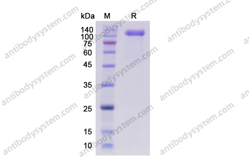 Recombinant Human CD56/NCAM1 Protein, C-His