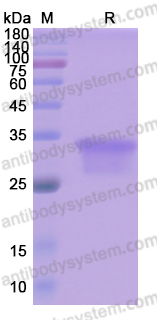 Recombinant Human OSM/Oncostatin-M Protein, C-His