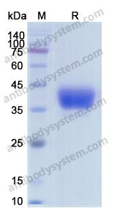 Recombinant Human CD142/F3/TF Protein, C-His