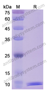 Recombinant Human MIF Protein, C-His