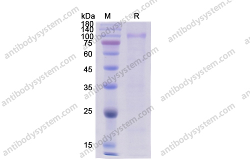 Recombinant Human HGF Protein, C-His