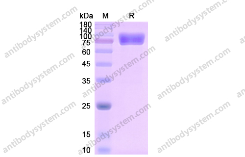 Recombinant Human CD121a/IL1R1 Protein, C-Fc