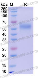 Recombinant Human CD121a/IL1R1 Protein, C-His