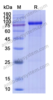 Recombinant Human MMP9 Protein, C-His