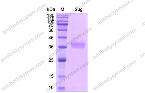 Recombinant Human CD122/IL2RB Protein, C-His