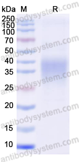 Recombinant Human LIF Protein, C-His