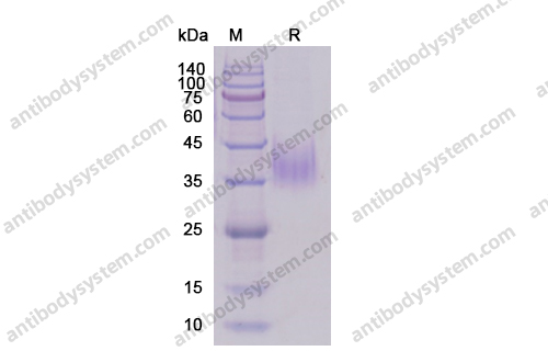 Recombinant Human CD119/IFNGR1 Protein, C-His