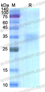 Recombinant Human FOLR1 Protein, C-His
