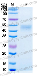 Recombinant Human CD19 Protein, C-His