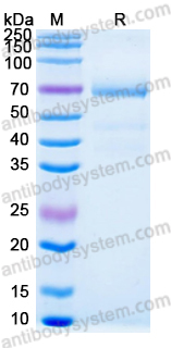 Recombinant Human CD19 Protein, C-Fc