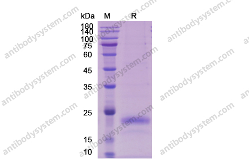 Recombinant Human VEGFA/VEGF165 Protein, C-His