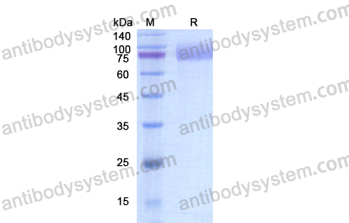 Recombinant Human CD140a/PDGFRA Protein, C-His