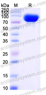 Recombinant Human CD31/PECAM1 Protein, C-His