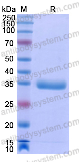 Recombinant Human PRLR Protein, C-His
