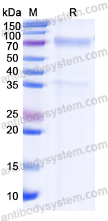 Recombinant Human TSHR/LGR3 Protein, C-Fc