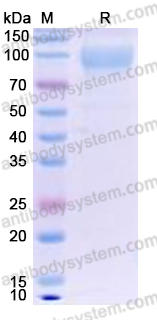 Recombinant Human CD62E/SELE Protein, C-His