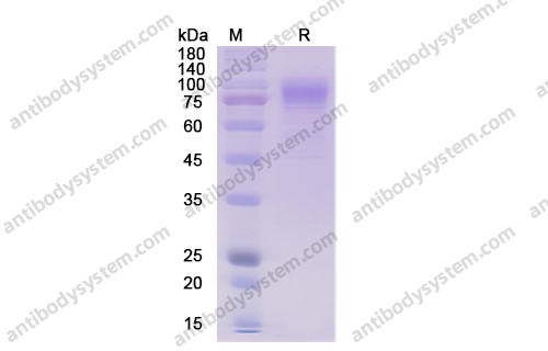 Recombinant Human CD36 Protein, C-His