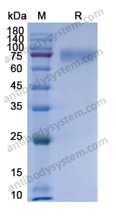 Recombinant Human IFNAR1 Protein, C-His
