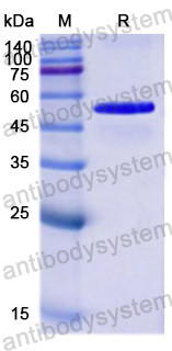 Recombinant Human TRIM21/RO52 Protein, N-His