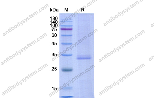 Recombinant Human AZU1/CAP37/HBP Protein, C-His