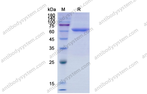 Recombinant Human CD73/NT5E Protein, C-His