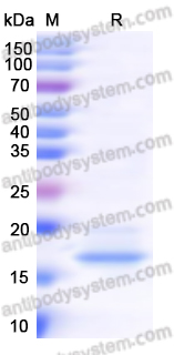 Recombinant Human IL10 Protein, C-His