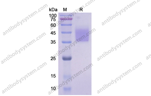 Recombinant Human CD124/IL4R Protein, C-His