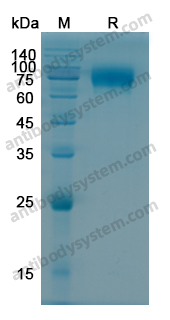 Recombinant Human CD124/IL4R Protein, C-Fc