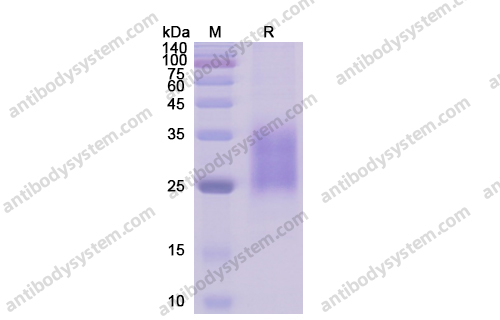 Recombinant Human CD95/FAS Protein, C-His