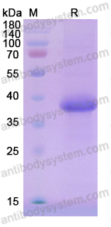 Recombinant Human ACRV1 Protein, C-His