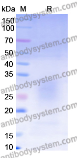 Recombinant Human CD314/KLRK1 Protein, C-His