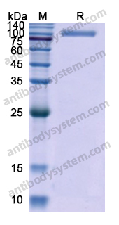 Recombinant Human CD26/DPP4 Protein, C-His