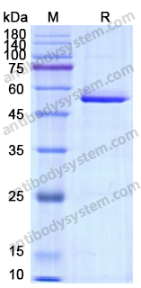 Recombinant Human Calreticulin/CALR Protein, C-His