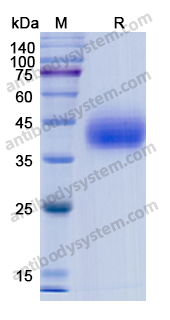 Recombinant Human CD38 Protein, C-His