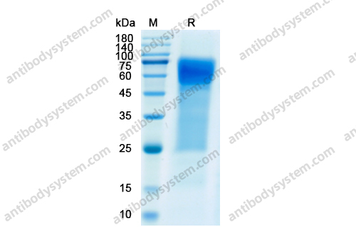 Recombinant Human CD30/TNFRSF8 Protein, C-His