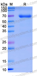 Recombinant Human CD1b Protein, C-Fc