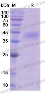 Recombinant Human CTGF/CCN2 Protein, C-His