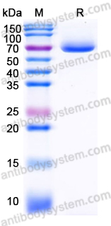 Recombinant Human EPHA2 Protein, C-His