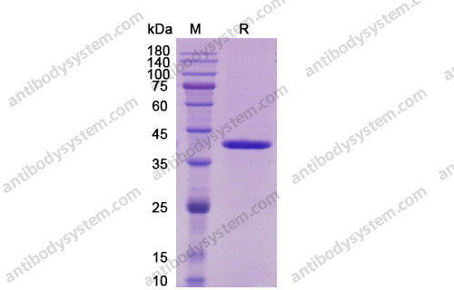 Recombinant Human IL12B/IL-12 p40/NKSF2 Protein, C-Flag