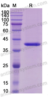 Recombinant Human IL12B/IL-12 p40/NKSF2 Protein, C-His