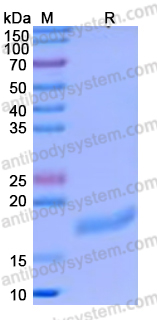 Recombinant Human CD154/CD40LG/TNFSF5 Protein, C-His