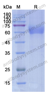 Recombinant Human AXL/UFO Protein, C-His