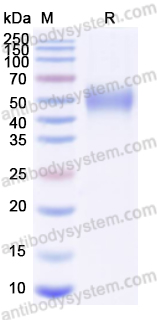 Recombinant Human CD132/IL2RG Protein, C-His