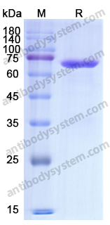 Recombinant Human DSG3 Protein, C-His