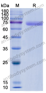 Recombinant Human DSG3 Protein, C-His