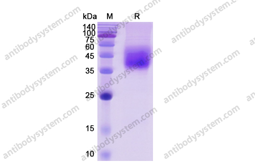 Recombinant Human CD80/B7-1 Protein, C-His