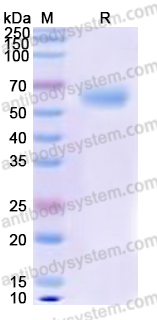 Recombinant Human CD68 Protein, C-His