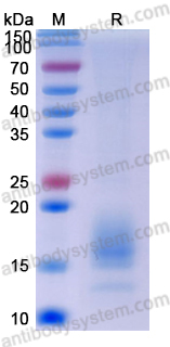 Recombinant Human ACVR1B Protein, C-His