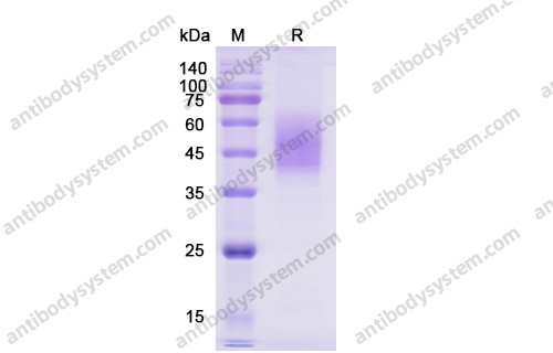 Recombinant Human CD86/B7-2 Protein, C-His