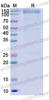 Recombinant Human CD118/LIFR Protein, C-His